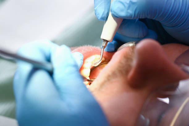 Best Urgent Care for Lost Fillings or Crowns in Socorro, TX