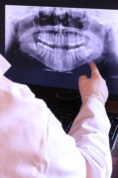 Best Emergency Treatment for Dental Infections or Abscesses in Socorro, TX