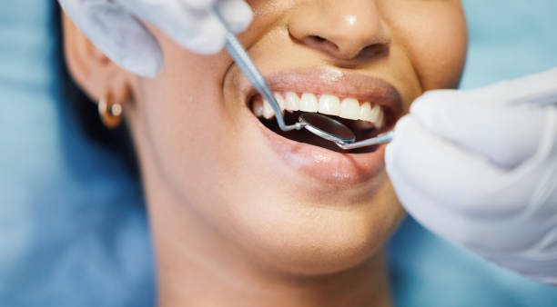 Best Emergency Dental Care for Broken or Chipped Teeth in Socorro, TX
