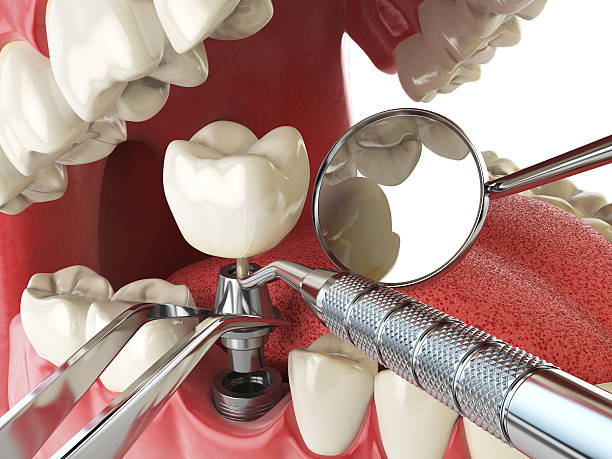 Best Cosmetic Emergency Dentistry in Socorro, TX