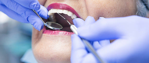 Best Emergency Treatment for Dental Infections or Abscesses in Socorro, TX