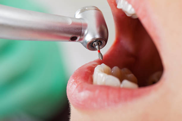 Best Emergency Denture Repair in Socorro, TX